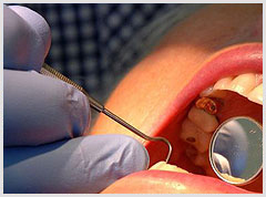 Urgencias Odontologicas en Istmina